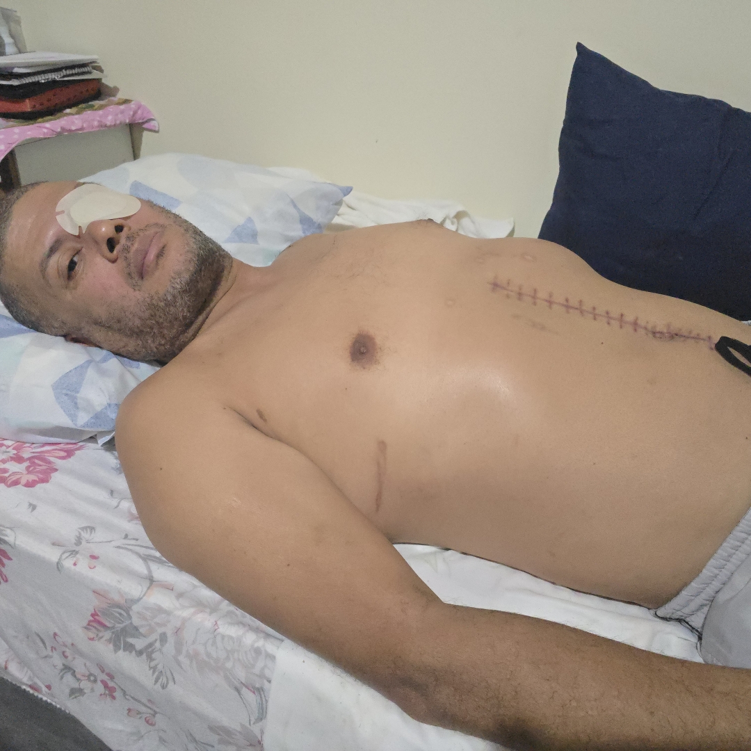 Motociclista que foi atingido de frente por carro conduzido por homem embriagado pede justiça