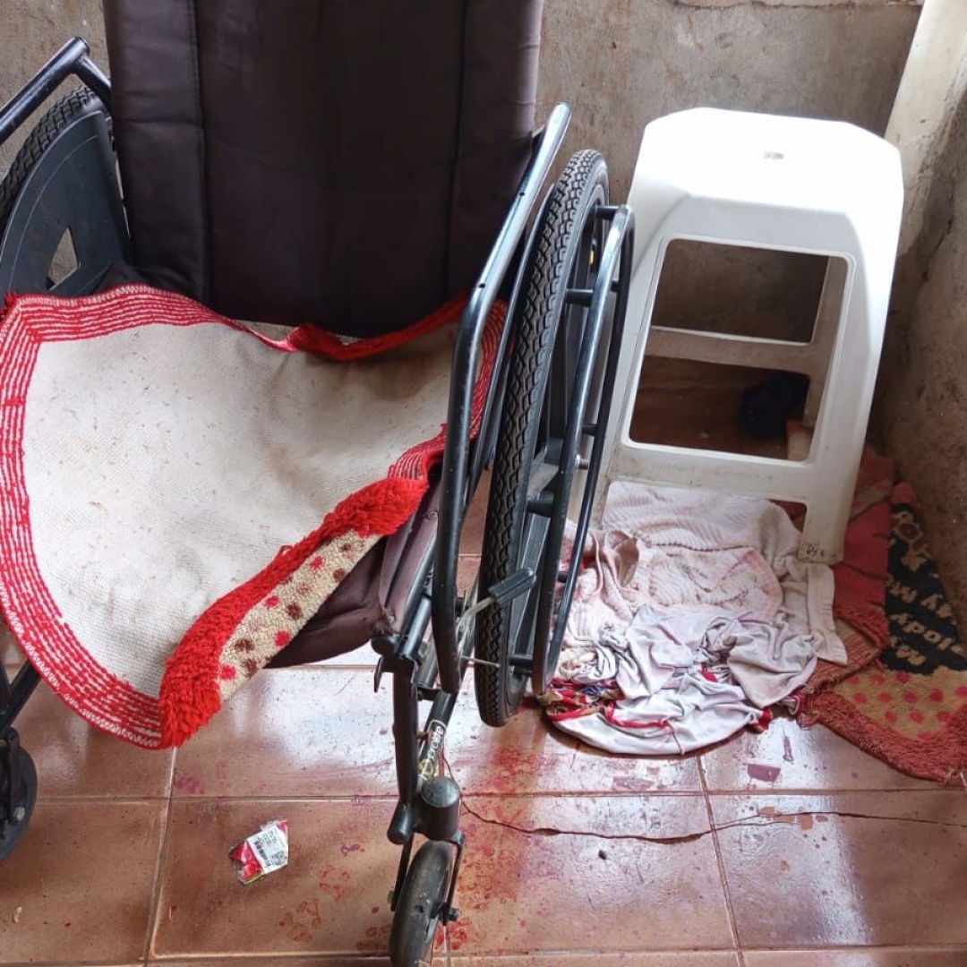 Idosa de 89 anos tem dedos arrancados e braço dilacerado após ser atacada por cão