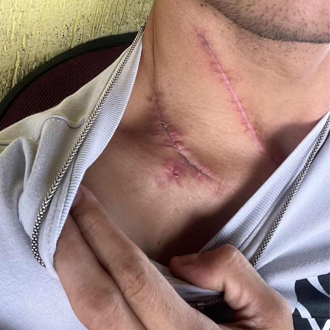 Vídeo inédito mostra rapaz sendo atacado e esfaqueado durante briga de trânsito em Maringá