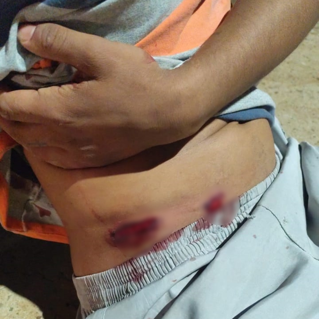 Rapaz baleado por policiais no ano passado sofre uma tentativa de homicídio em Floresta