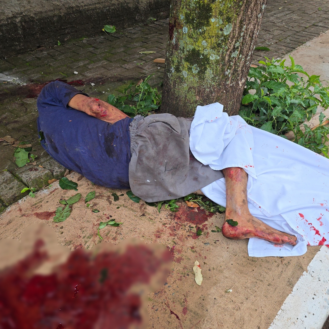 Rapaz suspeito de praticar furtos na cidade de Floresta fica gravemente ferido ao ser espancado