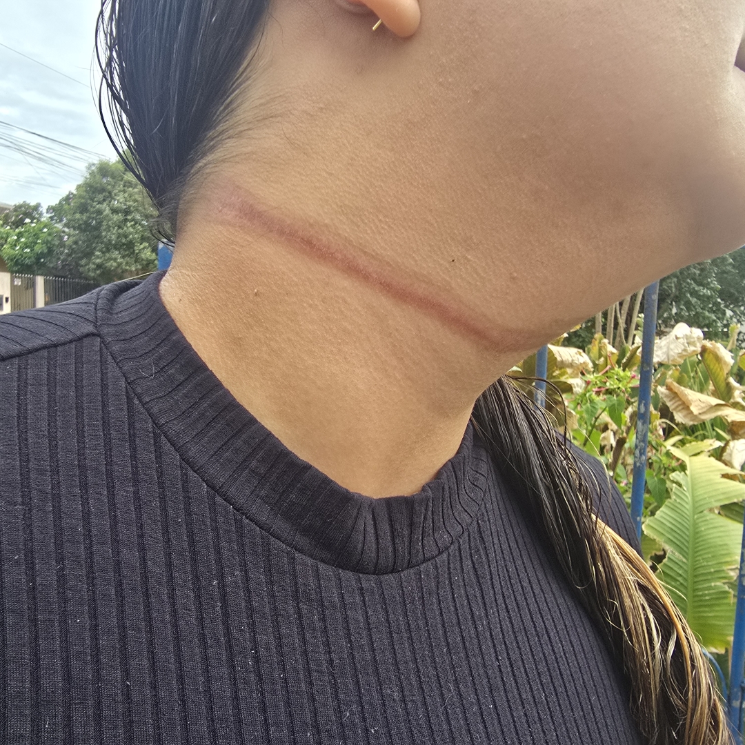 Mulher é atingida no pescoço por fios de fibra óptica em Maringá