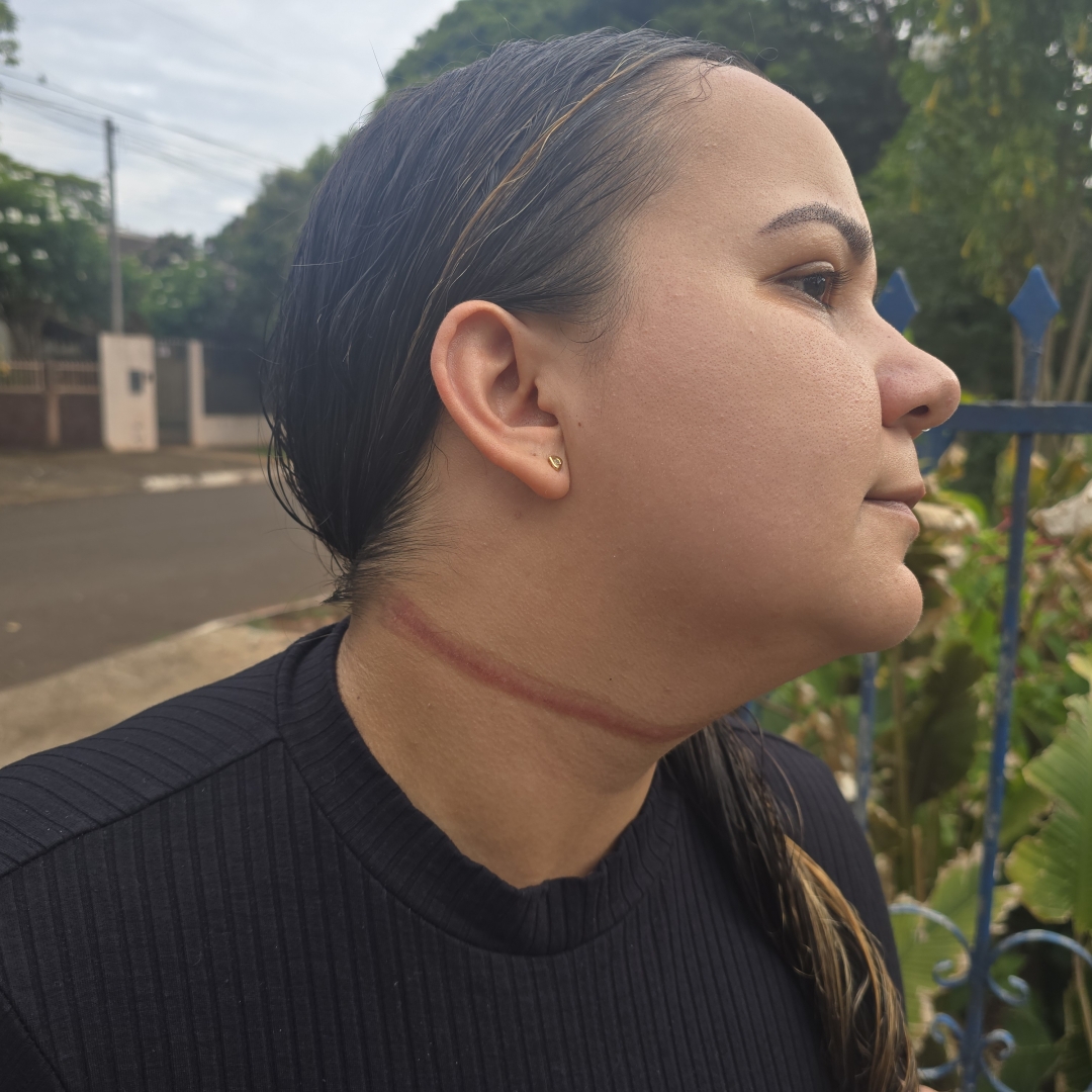 Mulher é atingida no pescoço por fios de fibra óptica em Maringá