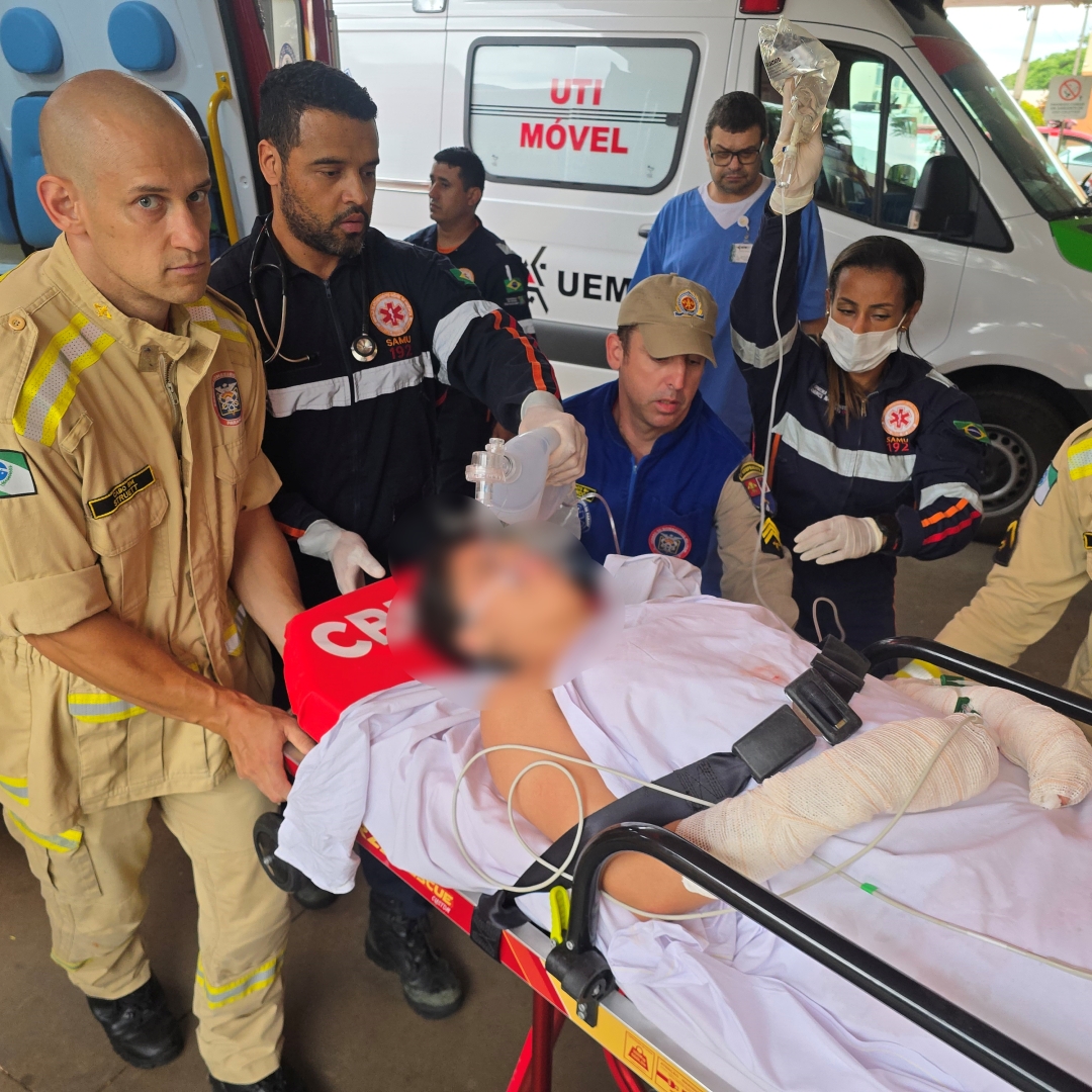 Mulher sofre queimaduras em mais de 80% do corpo ao acender réchaud de buffet