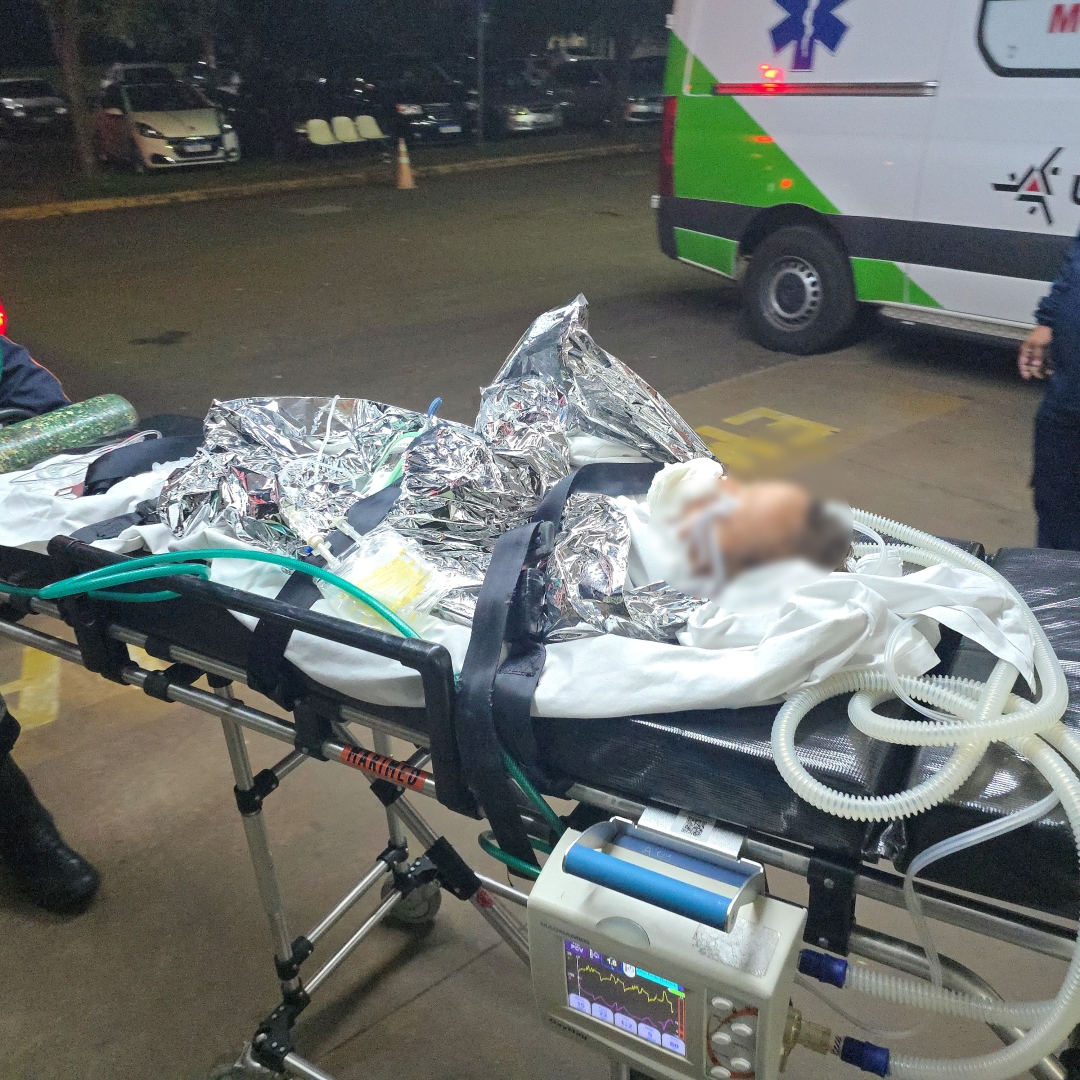 Criança de 1 ano é entubada após chaleira com água quente cair sobre seu corpo