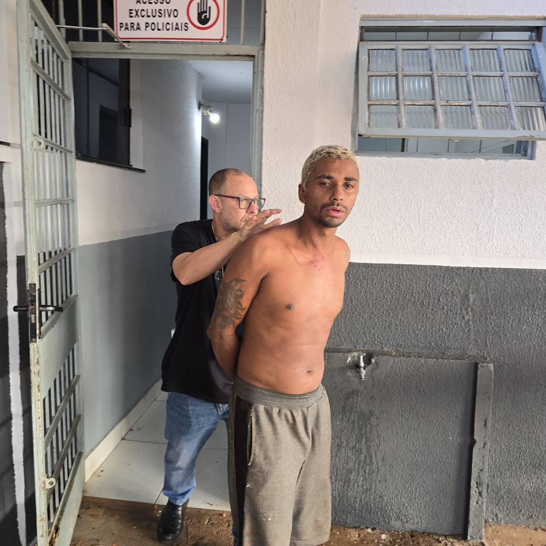 Mulher é entubada após companheiro atear fogo contra seu corpo durante uma briga