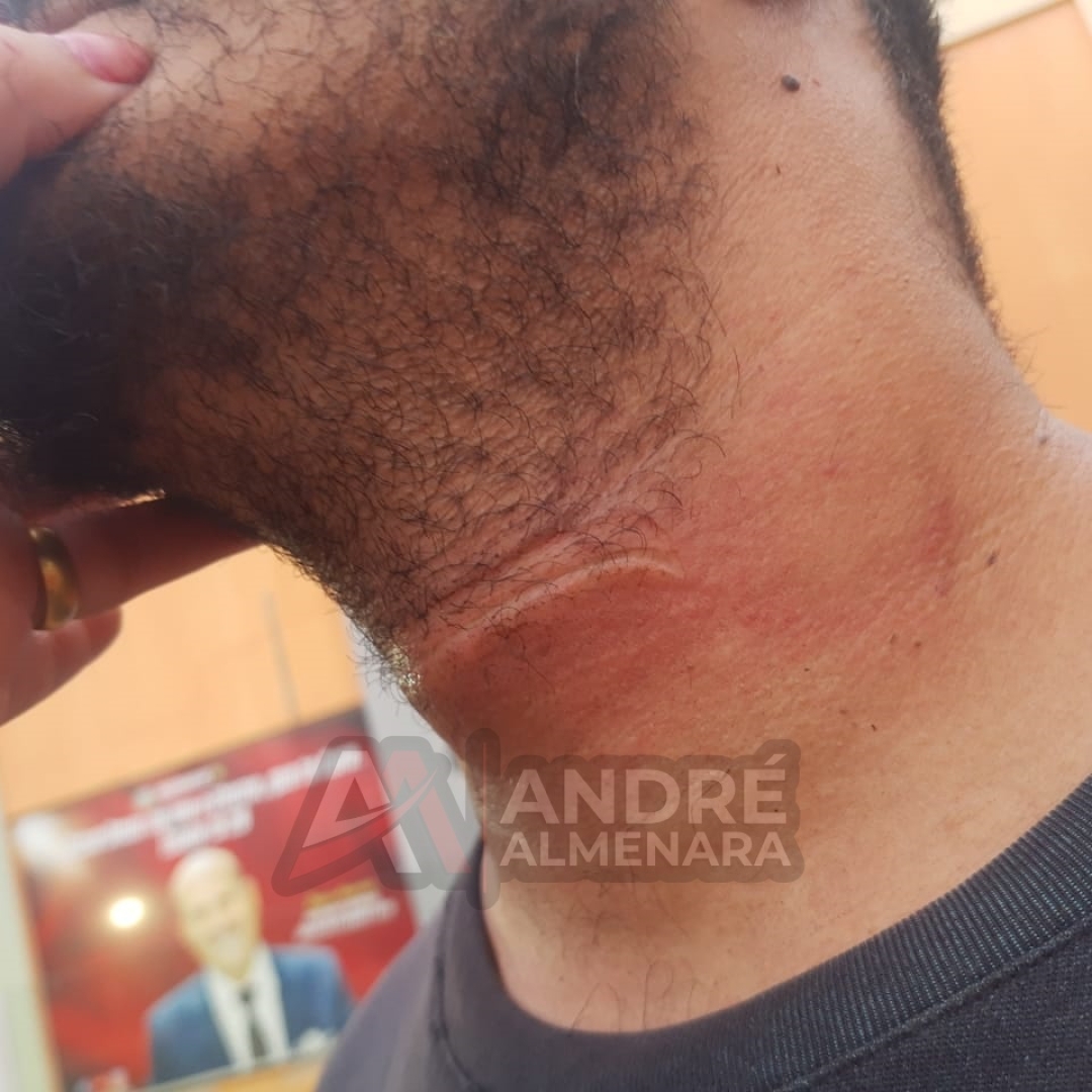 Fio de internet atinge pescoço de motociclista e causa queda em avenida de Maringá