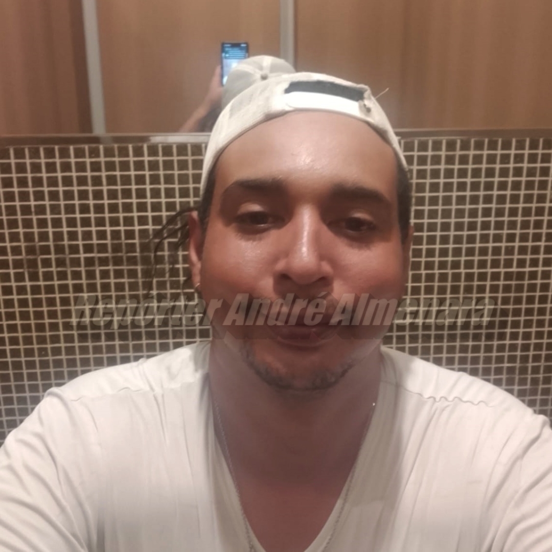 Maringaense morre após motocicleta atropelar animal solto na PR-463