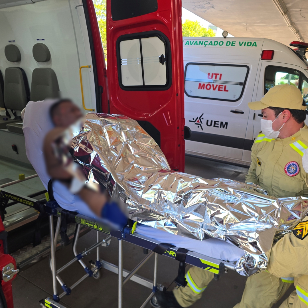 Homem que perdeu a perna em grave acidente sofre novas queimaduras após explosão de álcool em tacho em Sarandi
