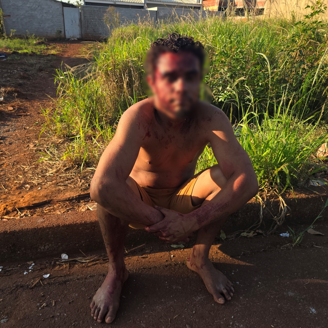 Discussão termina com jovem ferido por golpes de faca na cabeça em Sarandi