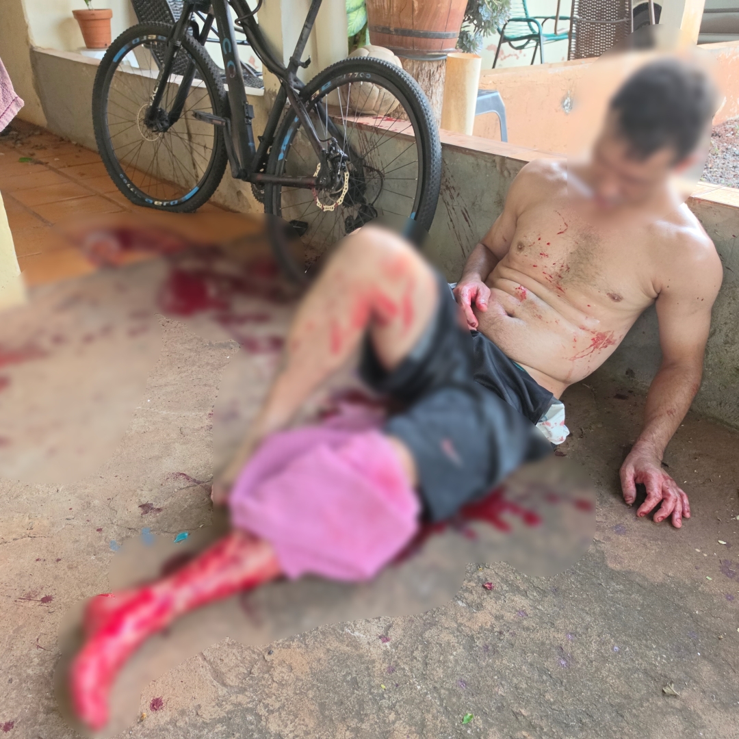 Homem sofre várias facadas em residência e agressor foge ensanguentado em Maringá