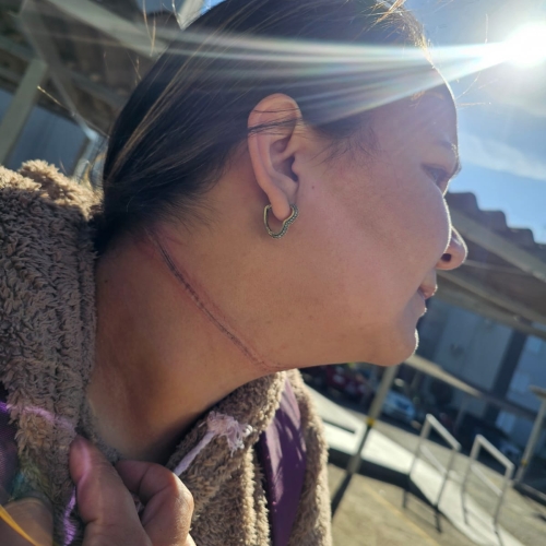 Mulher é atingida no pescoço por fios de fibra óptica em Maringá