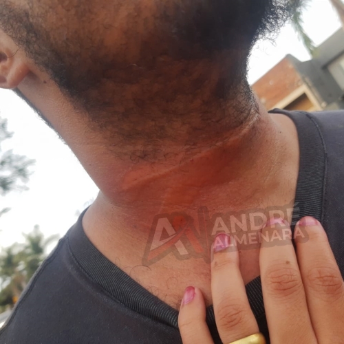 Fio de internet atinge pescoço de motociclista e causa queda em avenida de Maringá