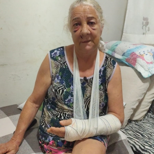 Mulher atropelada por moto na Avenida Brasil recebe alta hospitalar após sofrer múltiplas fraturas e complicações internas