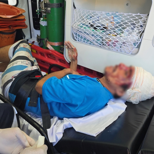 Violência no Conjunto Branca Vieira: homem é agredido a pauladas dentro da própria casa
