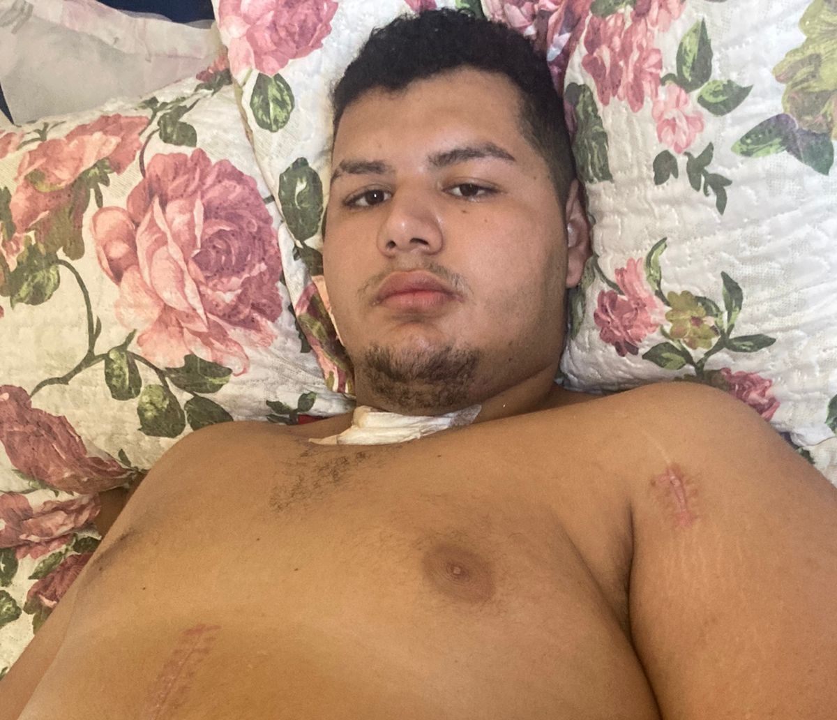 Jovem de 21 anos que ficou 24 dias em coma na UTI após sofrer acidente de moto recebe alta do hospital